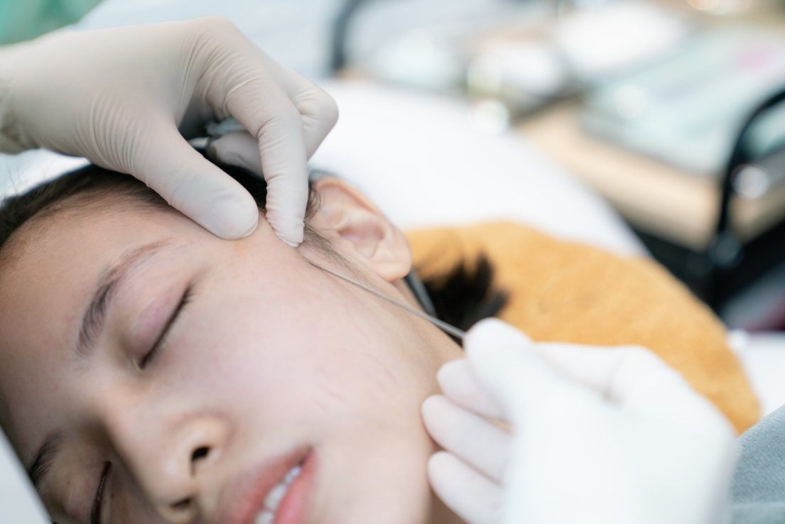 Top 5 Benefits Of Regenerative PRF Treatment For Faster Healing