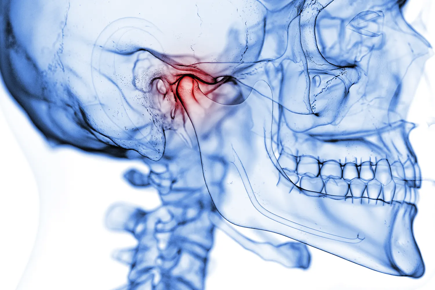 Featured image for “TMJ and the Neck: Stopping Chronic Headaches at the Source in Naperville”